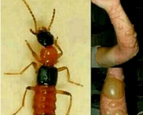 昆虫皮肤动作爆料视频大全,动作视频大全解析